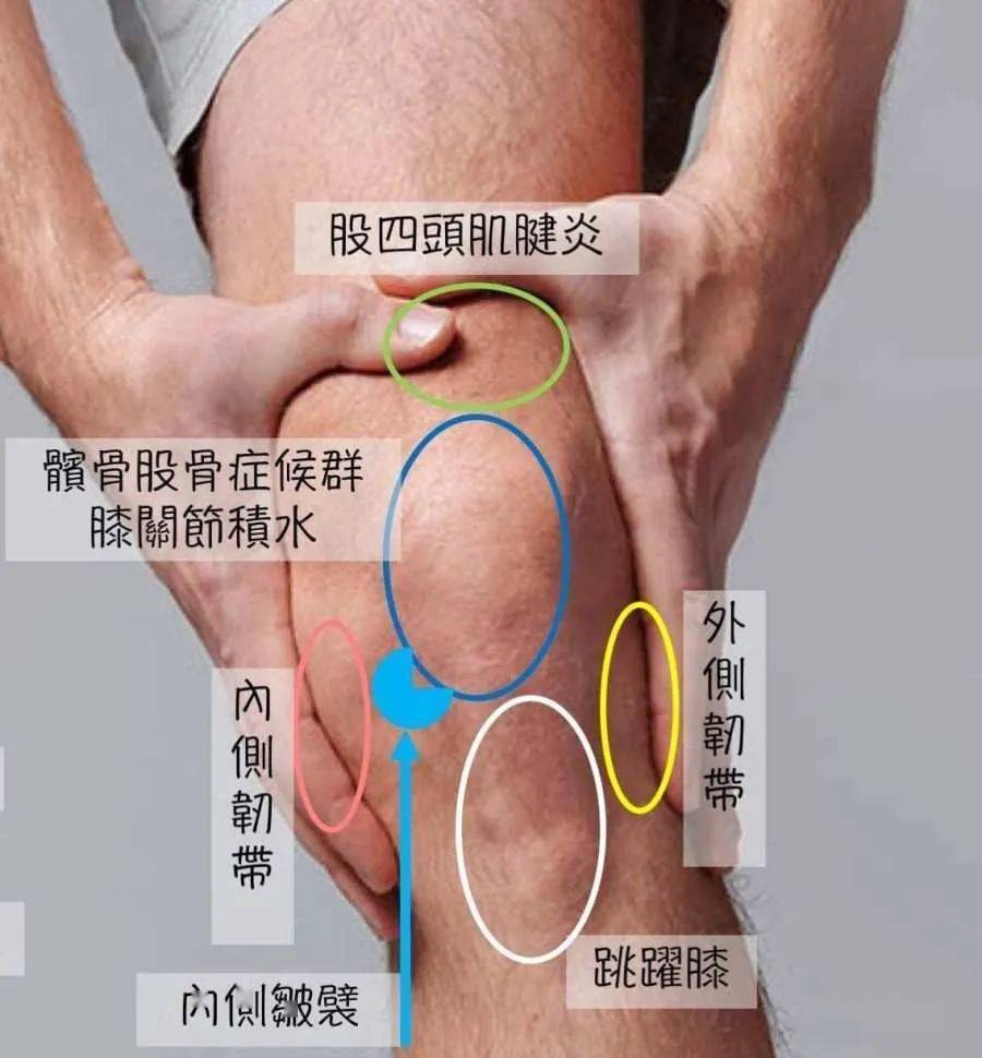 膝关节损伤体格检查