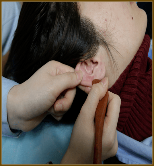 小耳朵能唤醒全身健康,真的很神奇～_皮肤_耳郭_部位