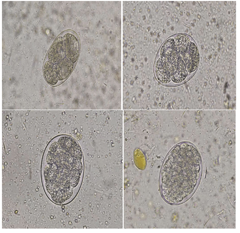 寄生虫虫卵图片大全图片