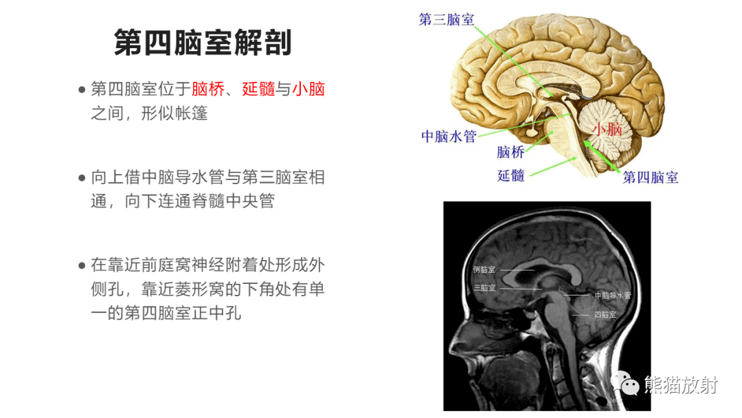 【省立影像读片】四脑室区病变2307