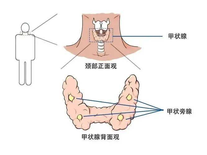 诊断与治疗 超声介入消融手术