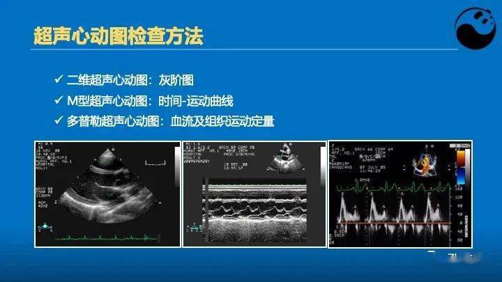 临床医生如何解读超声心动图报告_心脏_病例_患者