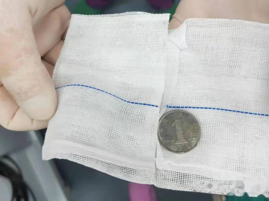 惊险！临海3岁幼儿误吞硬币，10小时后手术取出_搜狐网