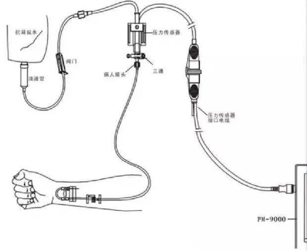 动脉换能器图片