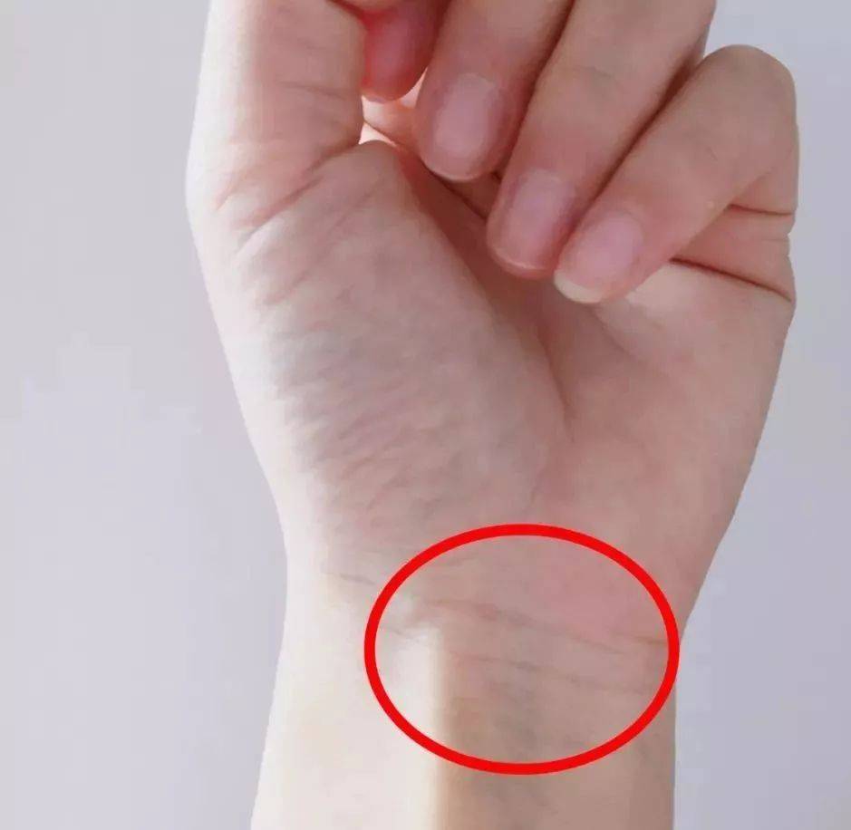 腕横纹下三寸即内关穴,如果此处青筋明显,则可能预示心脏供血不足,易