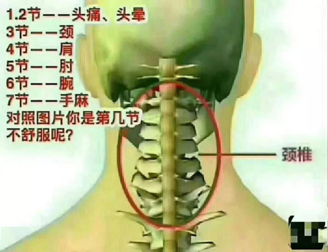 颈椎压迫神经的症状图片