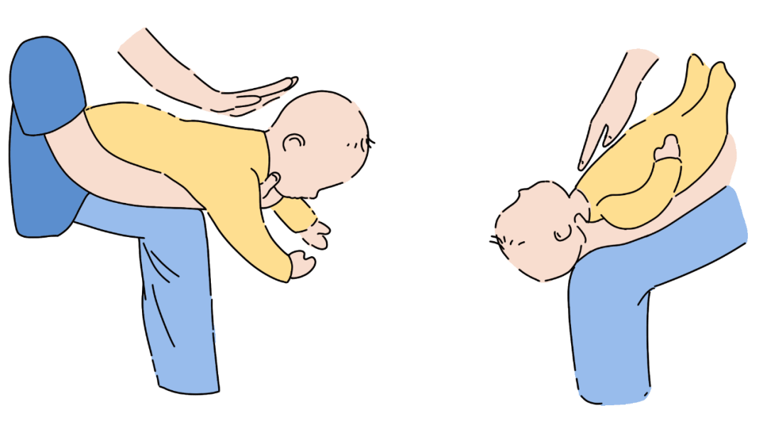 【世界急救日】气道异物梗阻怎么办?