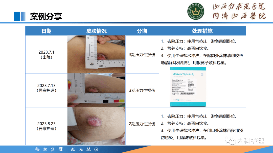【ppt】压力性损伤分期及伤口的评估与处理