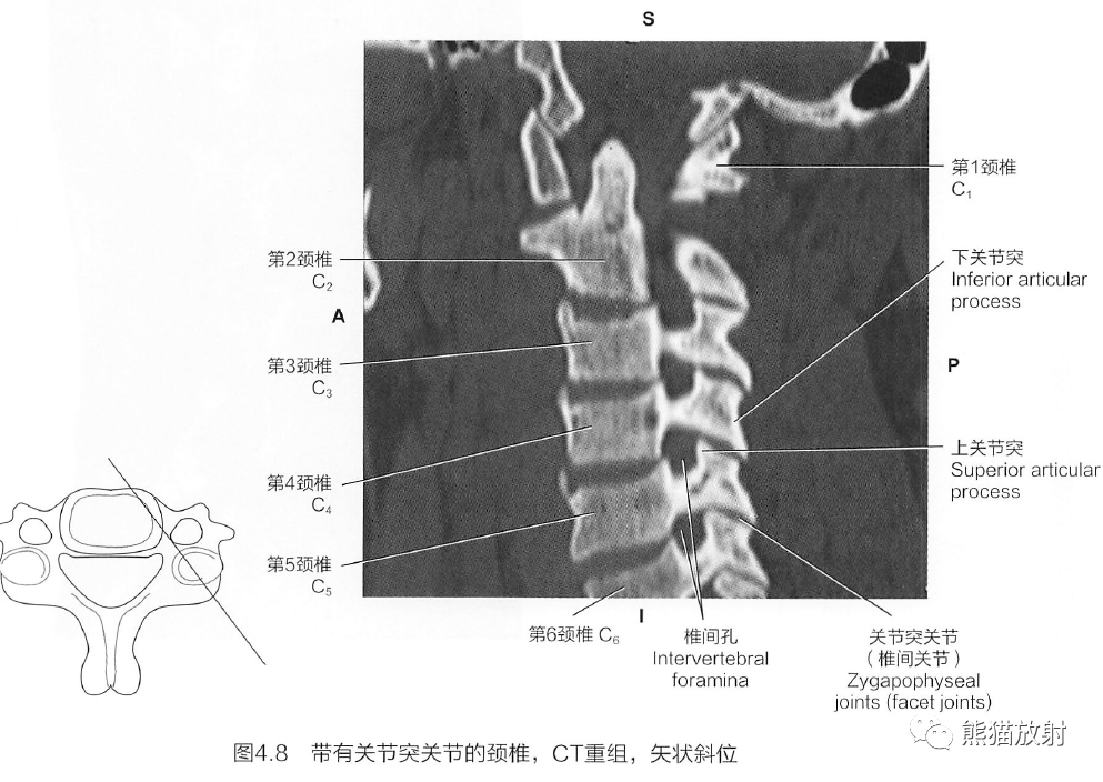 独特の素材 図説臨床整形外科講座〈第2巻〉頸椎・胸椎・胸郭 臨床医学