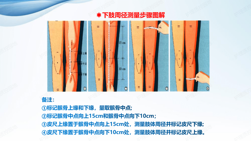 【ppt】下肢深静脉血栓行下肢周径规范测量专家共识_护理_管理_临床