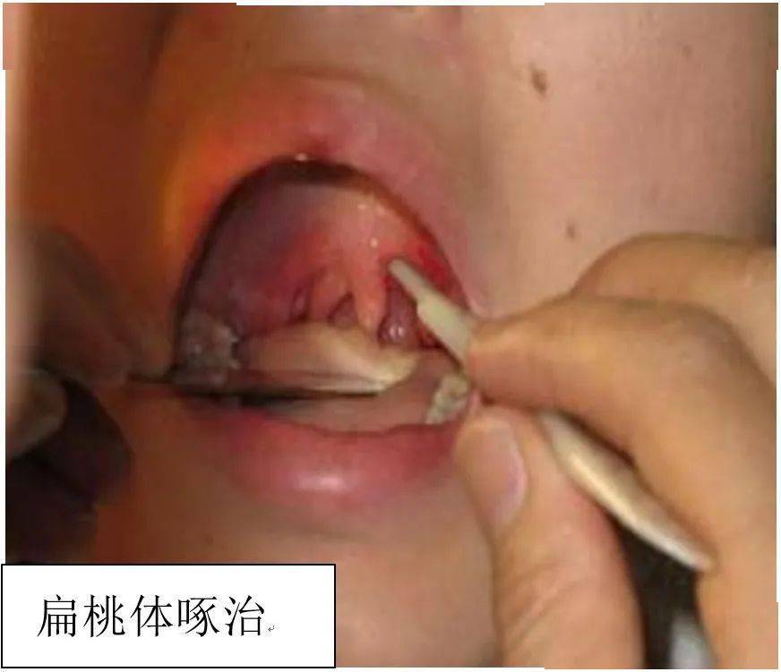 科普丨孩子越长越丑,可能是它惹的祸