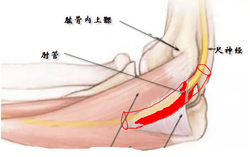 尺侧腕曲肌筋膜和支持带(又叫osborne弓状韧带)就组成了