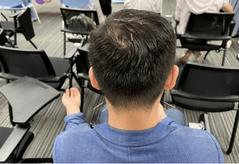 医善同行 | 关爱自"脊",中医义诊——为职工脊柱