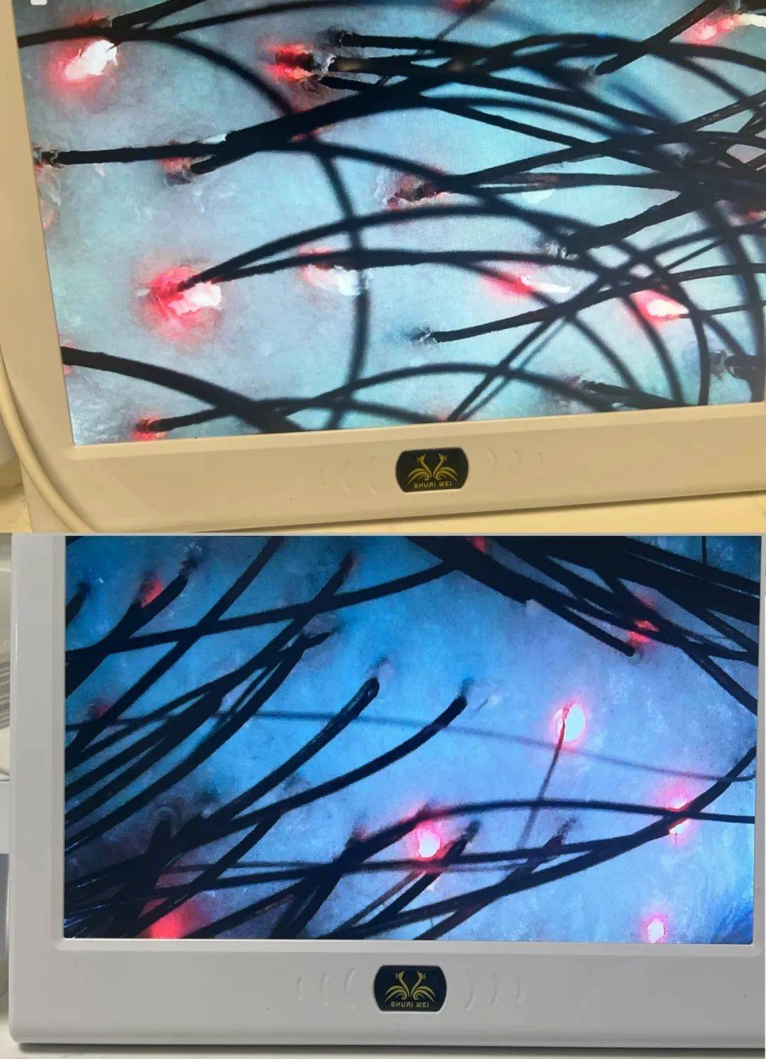 一个湾区人的周末解压routine_皮肤_brunch_头皮