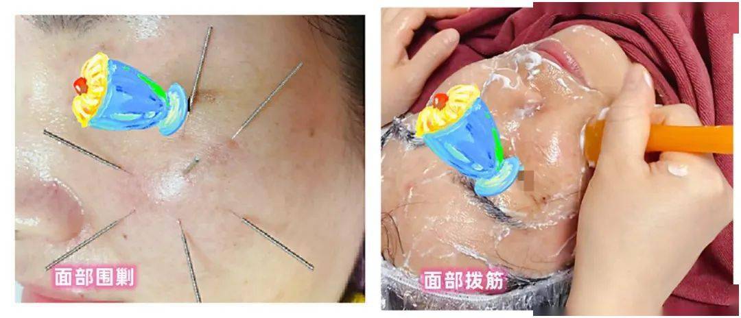 百"斑"无奈,万"斑"心酸,科学祛斑要知道!