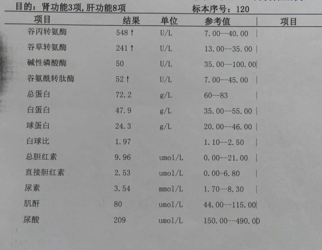 医生说:由于你对某一种抗结核药物(可能是异烟肼或利福平)产生了不良