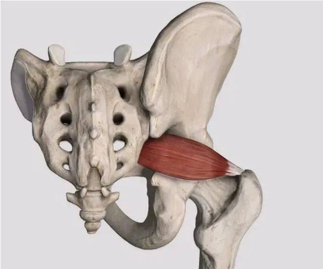 別急,可能是梨狀肌在搗鬼!_觸發_肌肉_患者
