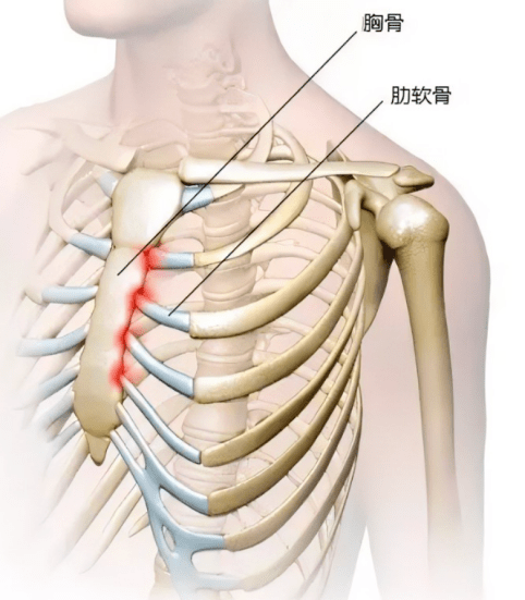 第二肋骨位置图图片