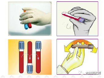 采血后立即轻轻上下颠倒5-10次,见图1.