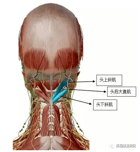 枕下肌群的解剖,功能及损伤原因和临床应用
