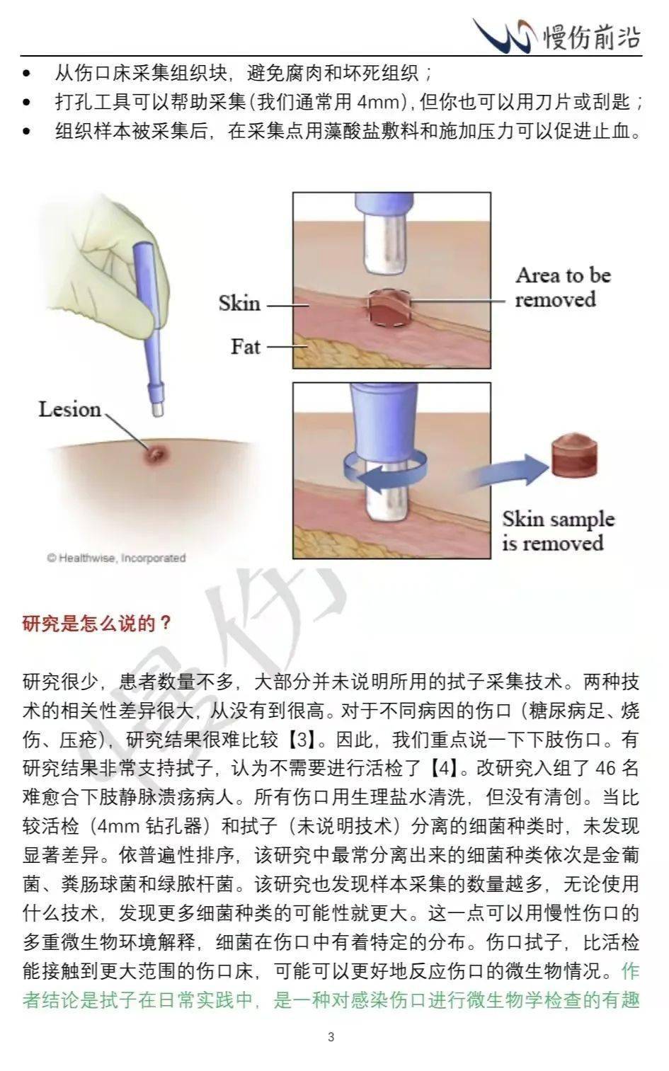可疑下肢溃疡感染：拭子或活检？_搜狐网