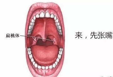 走進扁桃體的