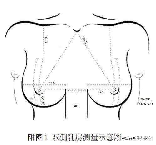 指南與共識|中國乳腺癌術後即刻假體乳房重建手術臨床