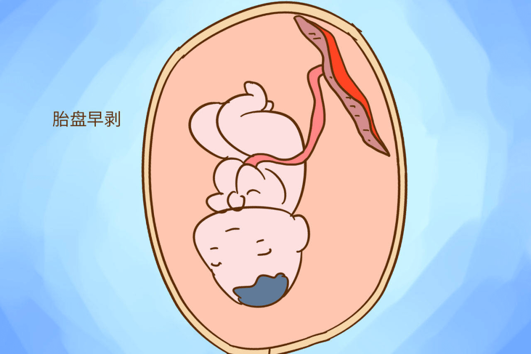 车祸胎儿喷出来了图片