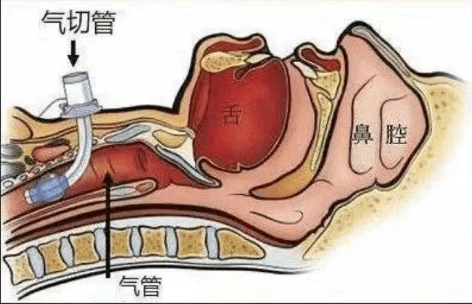 透视挂怎么下载_透视挂_透视挂软件下载