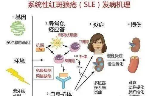 有研究表明,系統性紅斑狼瘡主要發病機制與t,b淋巴細胞異常活化有關.