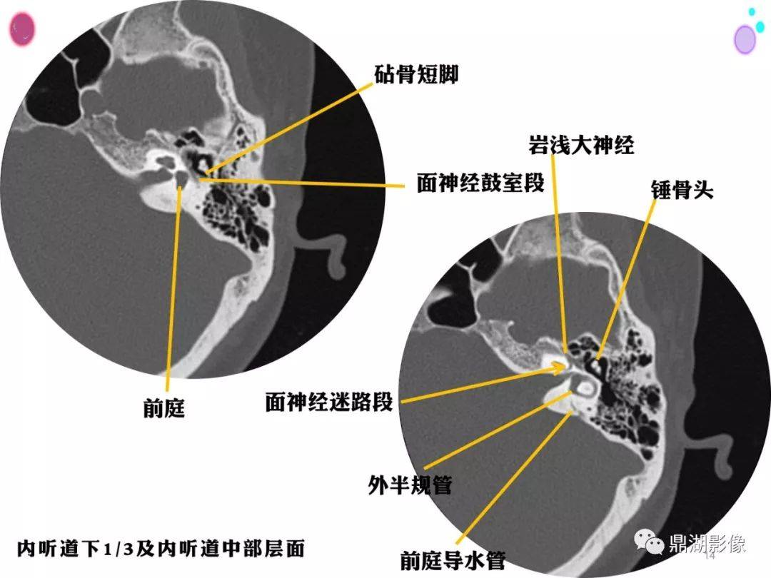 頭頸部高清ct斷層解剖(全)_全網_影像_系統