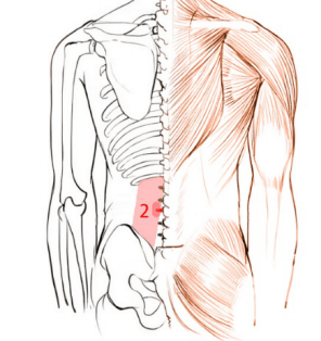 腰背部正中線兩側豎脊肌到骶骨位置,中間是脊柱,兩側是豎脊肌,豎脊肌