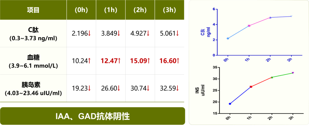 病例分享 | 舉步維艱:甲亢合併2型糖尿病,德谷胰島